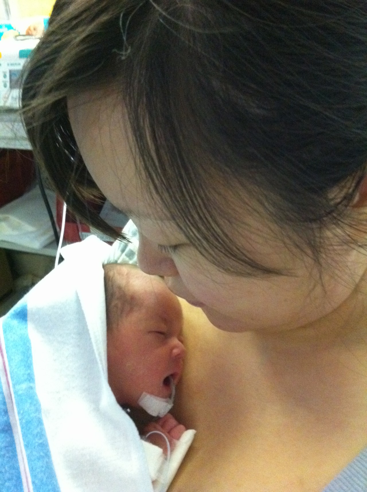 Really detested seeing my baby with a feeding tube